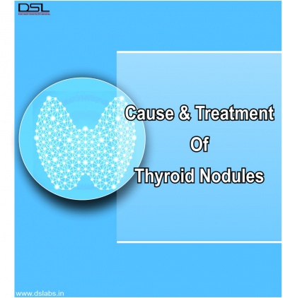 NODULAR THYROID